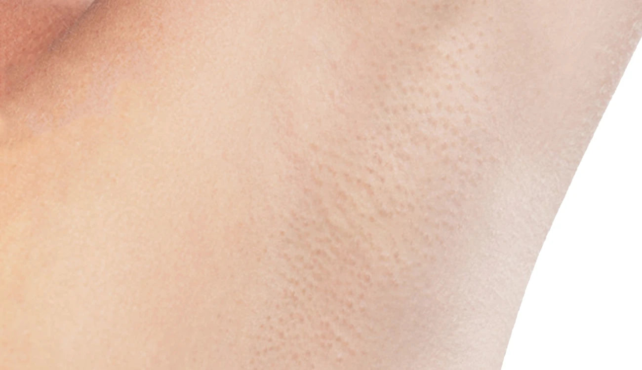 Visible Hair Removal Results